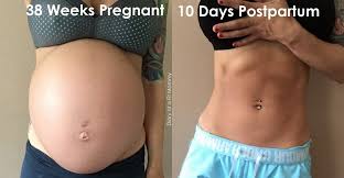 Loose Skin After Pregnancy